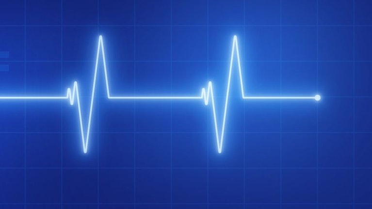 Eine Frau kommt mit starken Herzschmerzen ins Spital. Lebensgefahr! Aber es gibt kein elektronisches System, das zeigt, wo es freie OP-Teams und Intensivbetten gibt. Ärzte müssen das per Telefon erfragen. Über Stunden. Das Protokoll eines Versagens.